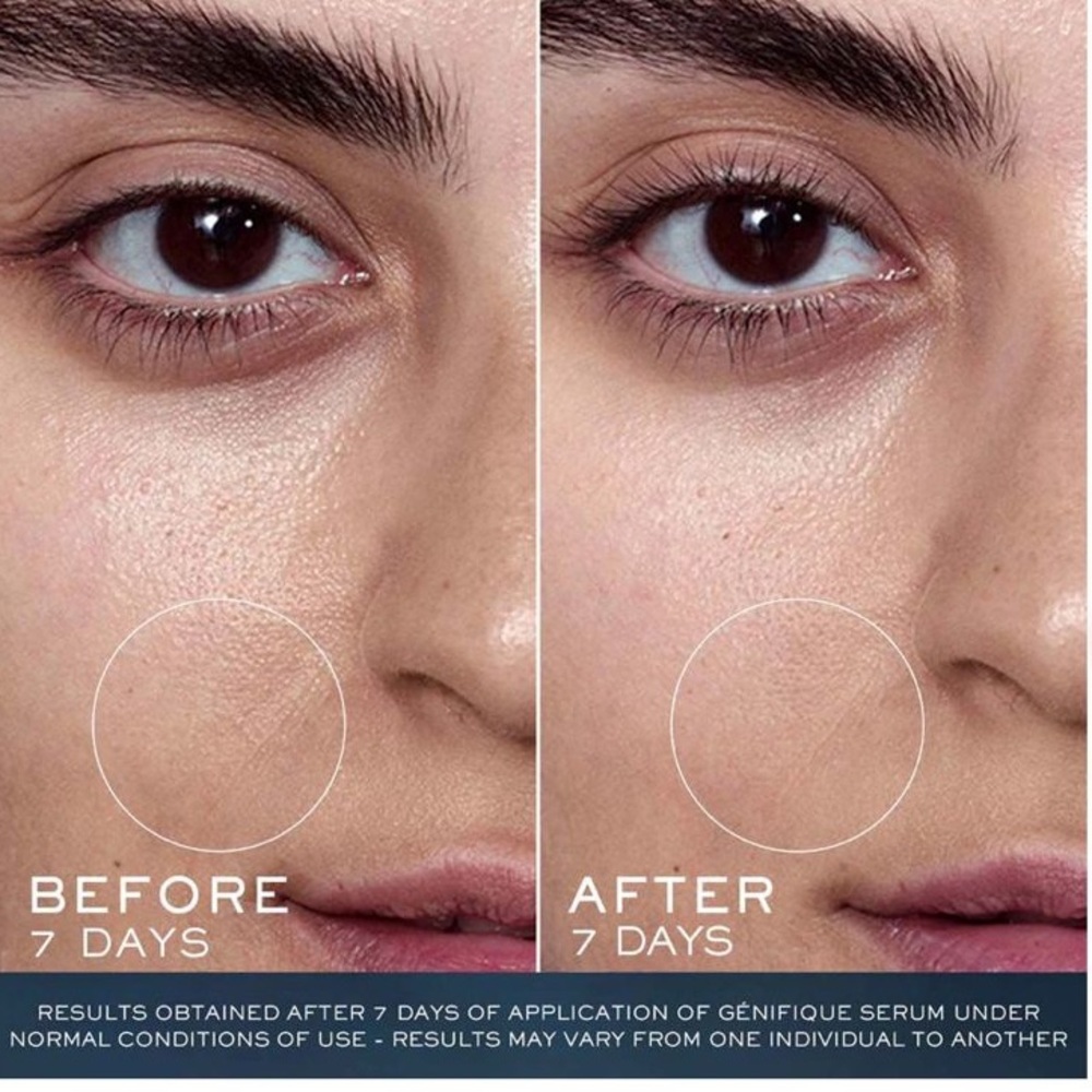 LANCOME ADVANCED GÉNIFIQUE
STRENGTHEN & REPAIR 3-STEP ROUTINE (A 220 VALUE) - Picture 3 of 6